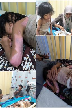 Sentuh Hati, LPAI Lampung Timur Jenguk dan Salurkan Donasi untuk Balita yang Tersiram Santan Panas di RSUD Abdul Moeloek