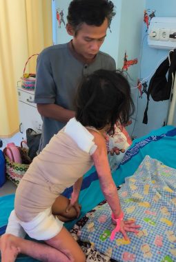 Senyum Kembali Mekar: Operasi Zulya Ulfa Jadi Simbol Solidaritas Lampung Timur